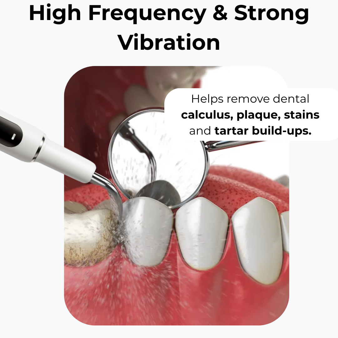 SmiSonic™ Home Tooth Cleaner – At-Home Solution for Tartar, Stains & Bad Breath