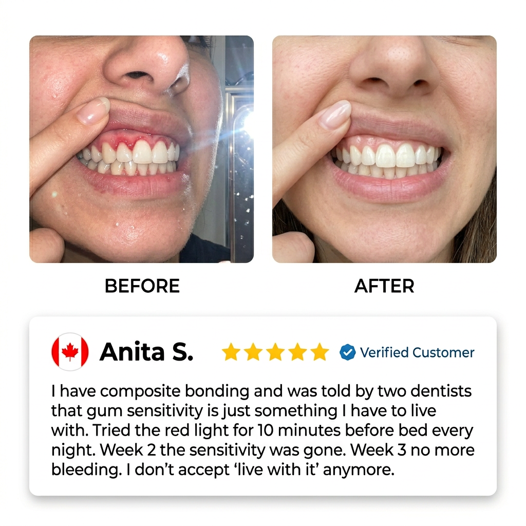 SmiVox™ Veneer Aftercare Kit